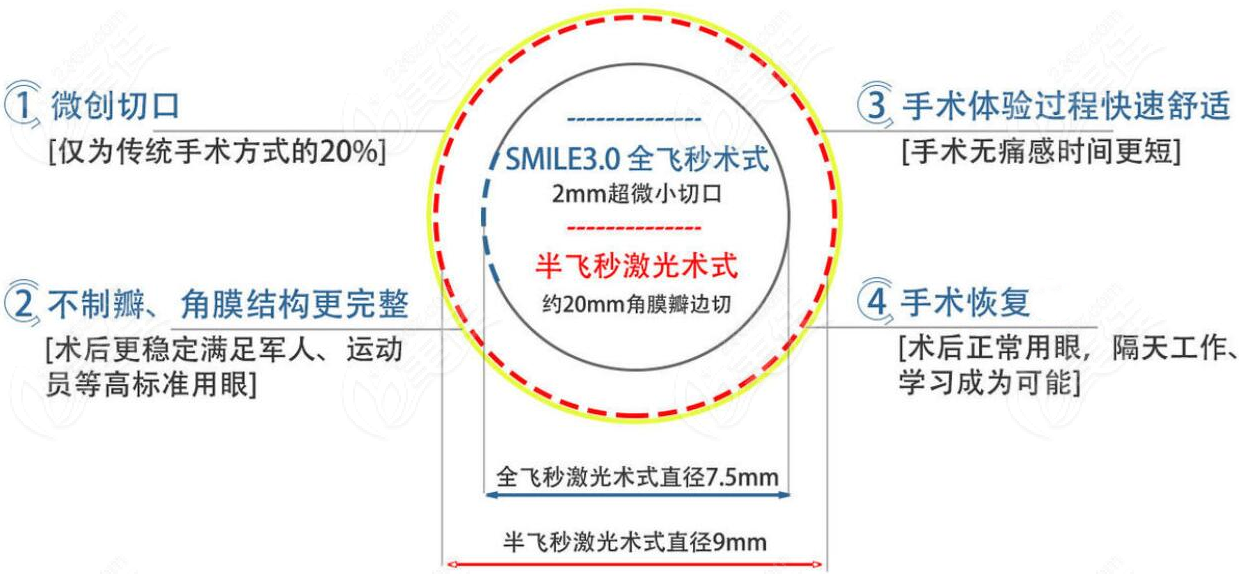 蔡司全飞秒激光手术优势
